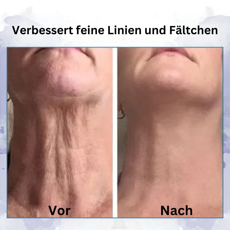 HebeCreme™ Anti-Falten Straffende Mehrzweckcreme