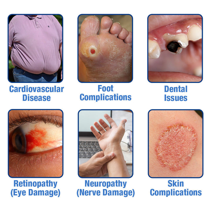 GesundheitsPatch™️ Blutzucker Balance Pflaster