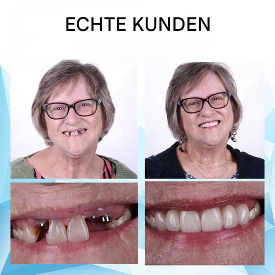 DentaFlex™ – Unterstützt das natürliche Aussehen & Gefühl Ihres Lächelns [50% Rabatt]