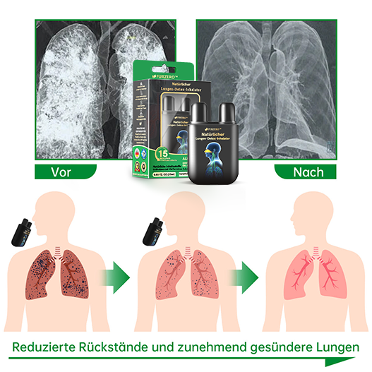 Furzero™ Natürlicher Lungen-Detox-Inhalator
