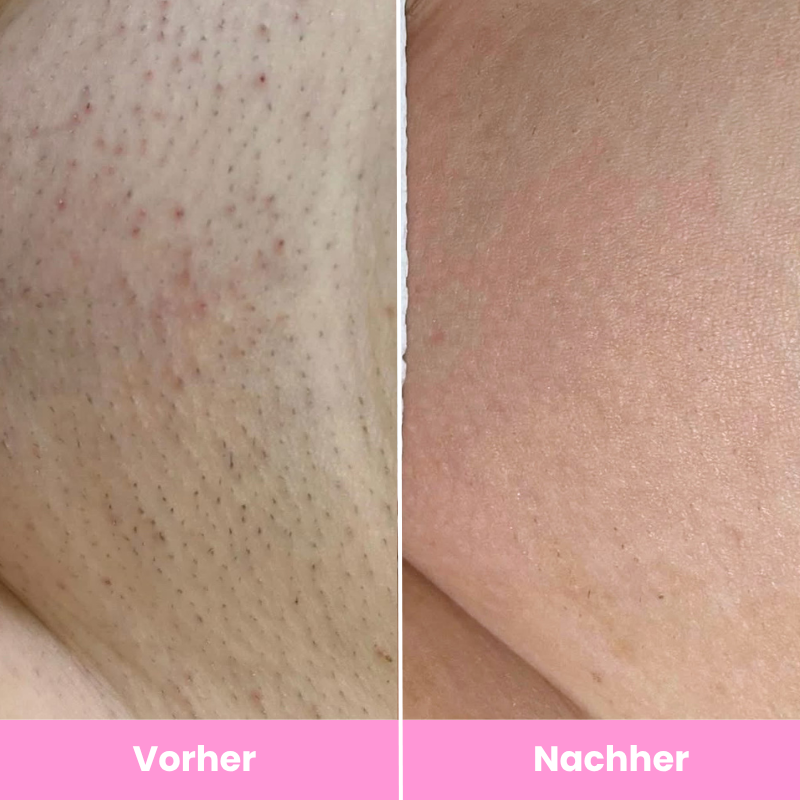 GlowEase™ Sommerpflege-Set