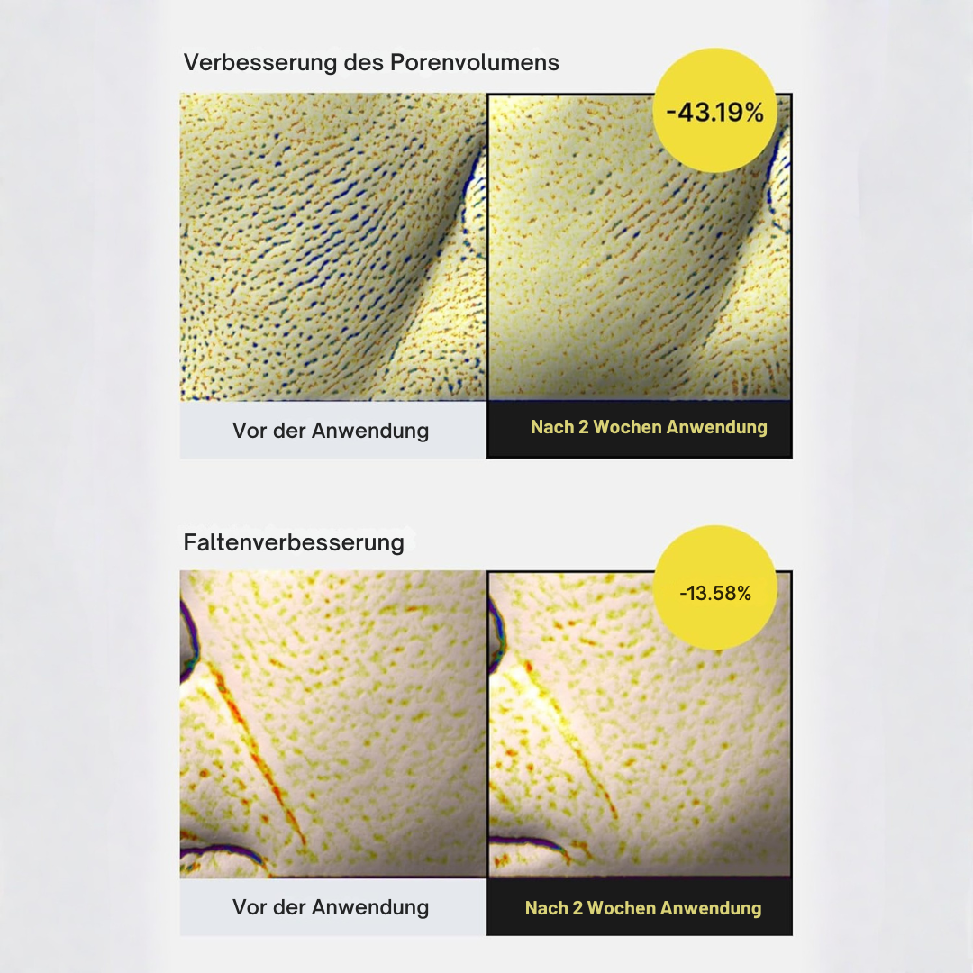 Vita-A Straffungspflege - Retinol-Power für sichtbar glattere und straffere Haut
