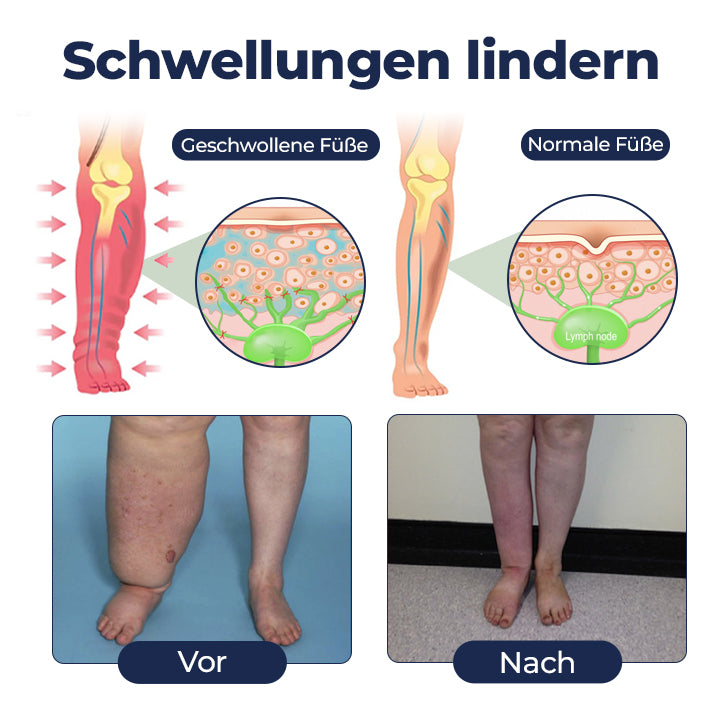 VenoEase™ Beincreme für ein leichtes, entspanntes Gefühl