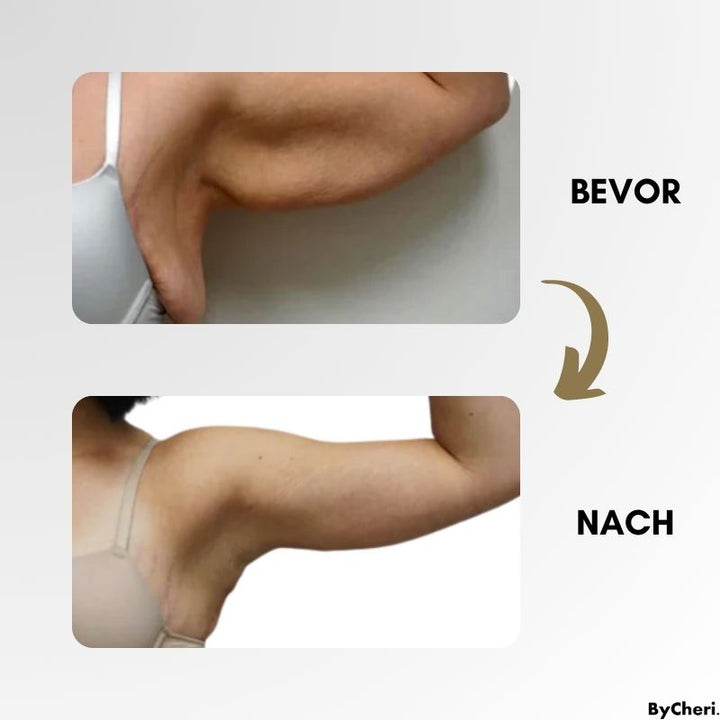 (50 % RABATT) LymphWave™- Hartnäckiges Fett mit Lymphstimulation bekämpfen