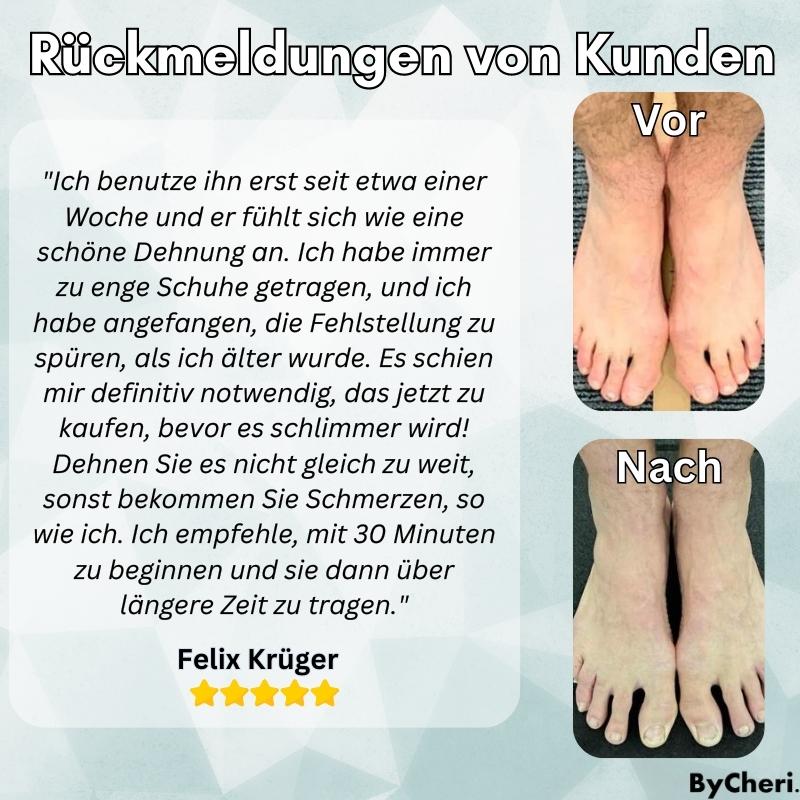 1+1 GRATIS TEMPORÄR | OrthoAlign™ – Großzehenkorrektor