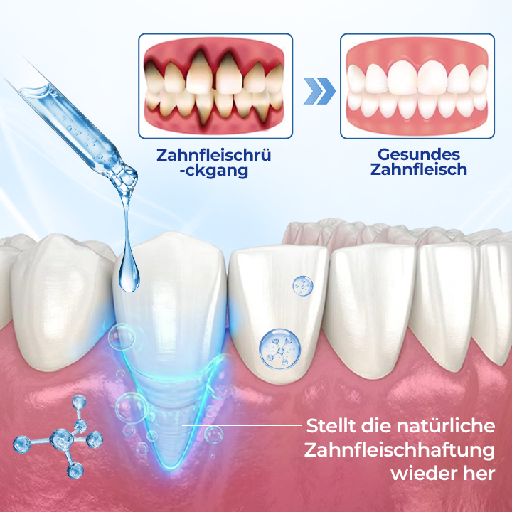 GumViva™ Mundtropfen für frischen Atem und zur Unterstützung des Zahnfleisches