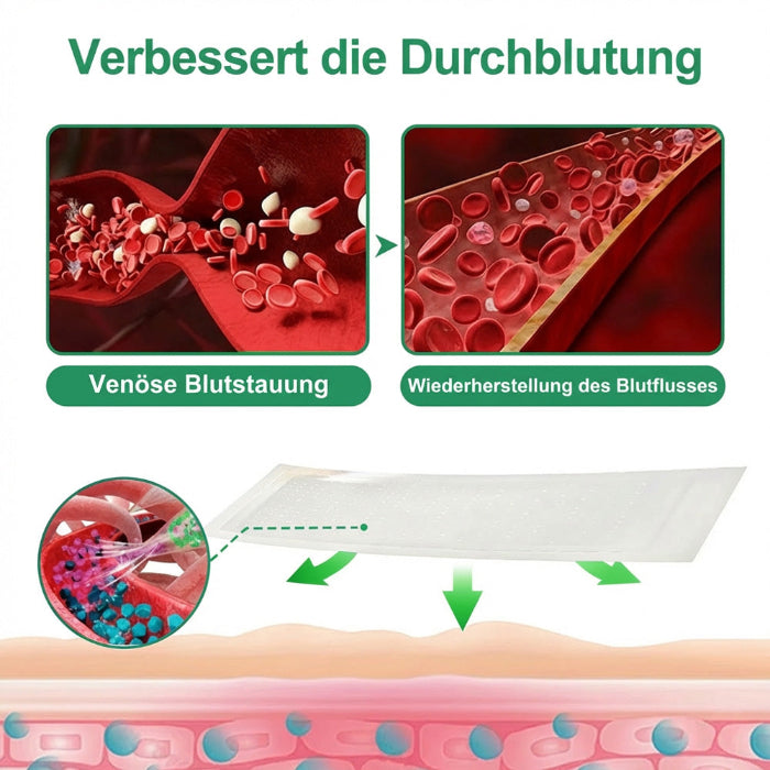 VenenSanft™ Mikronadel-Pflege für die Beine