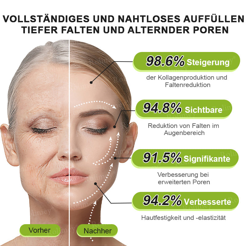 💫👨‍⚕️Jetzt jugendliche Haut zurückgewinnen 💫Rolimey® Botox & Vita-A Retinol Shot Falten-Lift Straffungscreme