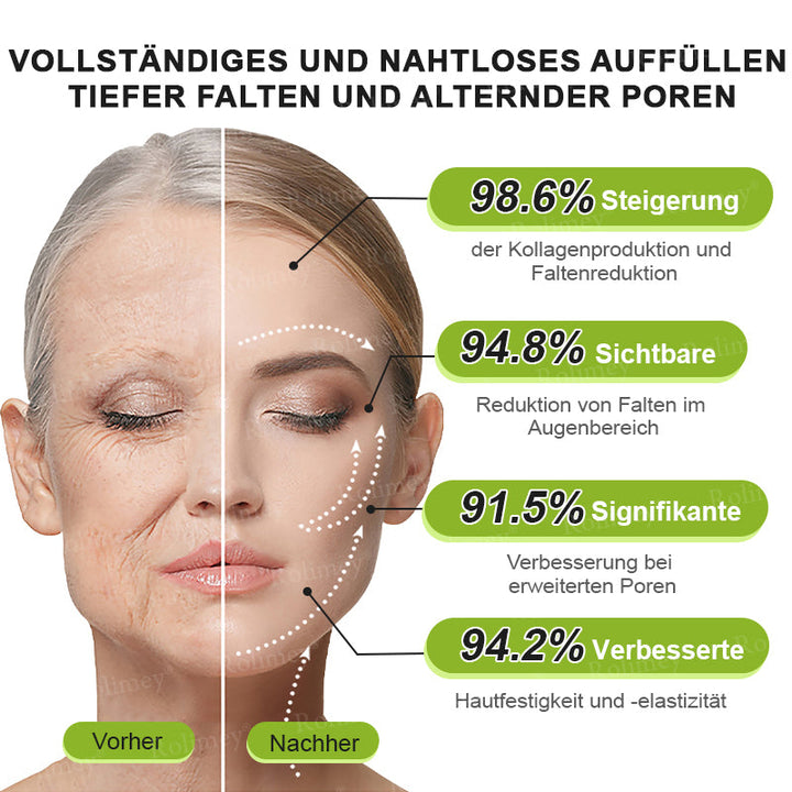 💫👨‍⚕️Jetzt jugendliche Haut zurückgewinnen 💫Rolimey® Botox & Vita-A Retinol Shot Falten-Lift Straffungscreme