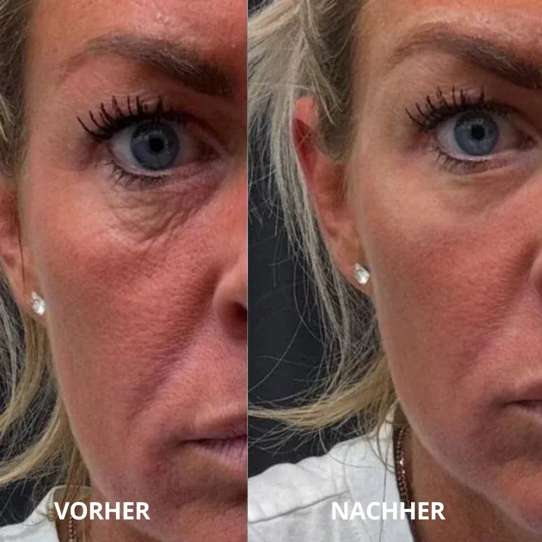 AugenFrisch™ Peptid-Kollagen-Augenpads