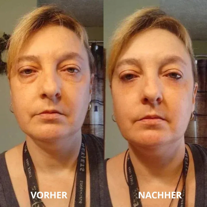 AugenFrisch™ Peptid-Kollagen-Augenpads