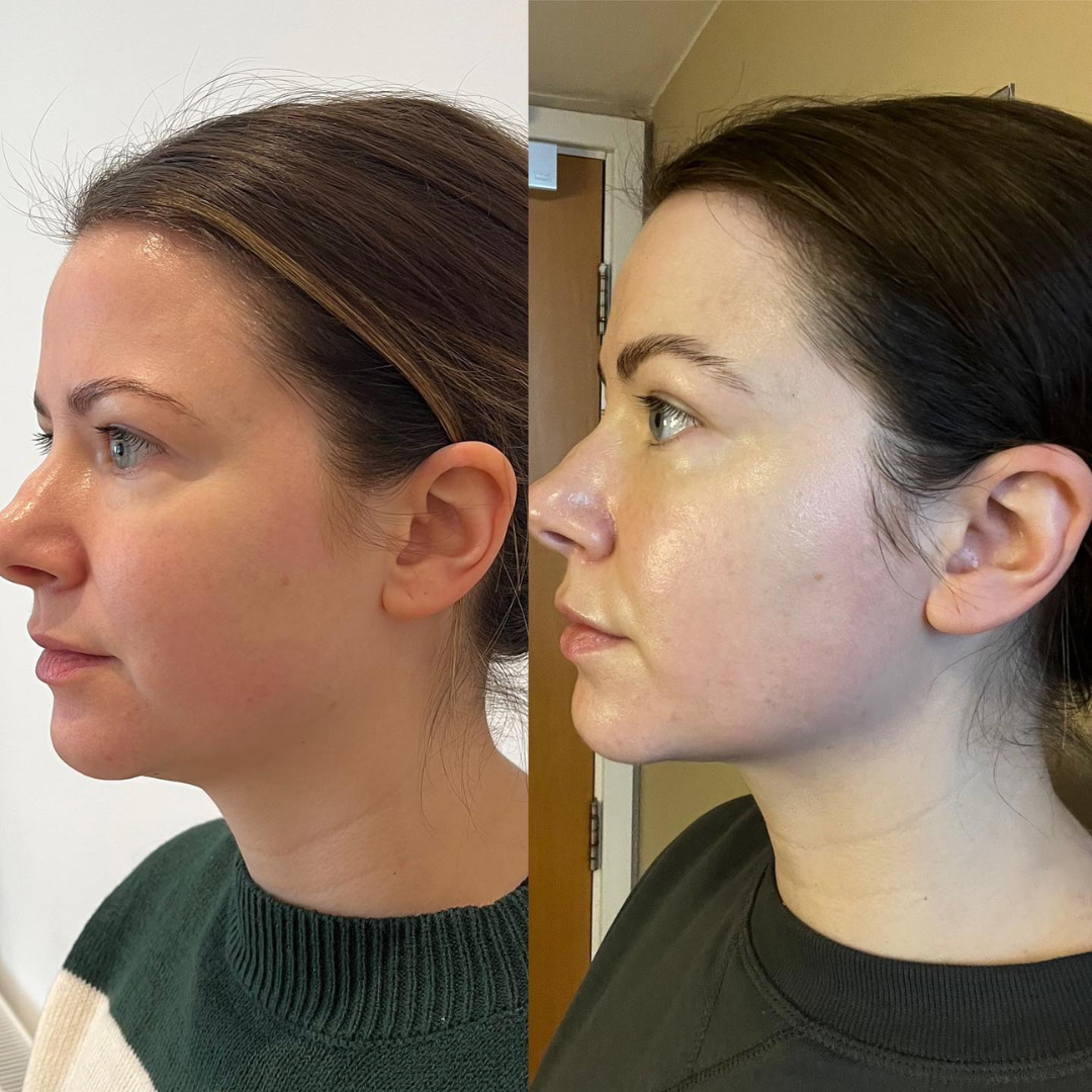 Lymphdrainage-Wellness-Tropfen