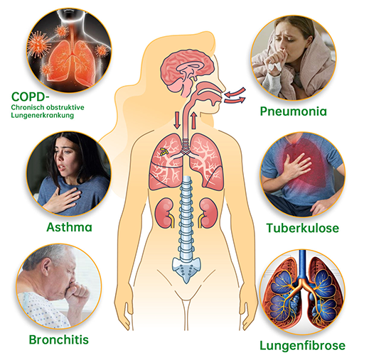 Furzero™ Natürlicher Lungen-Detox-Inhalator