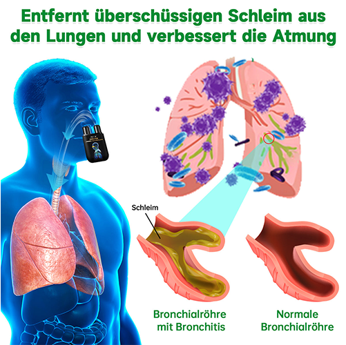 Furzero™ Natürlicher Lungen-Detox-Inhalator