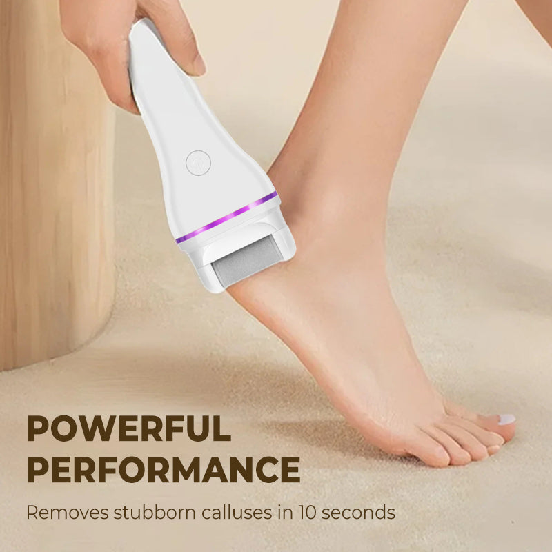 RamelleSmooth™ – Sag Lebewohl zu rauen Füßen und Hallo zu seidig-glatter Haut [50% Rabatt]