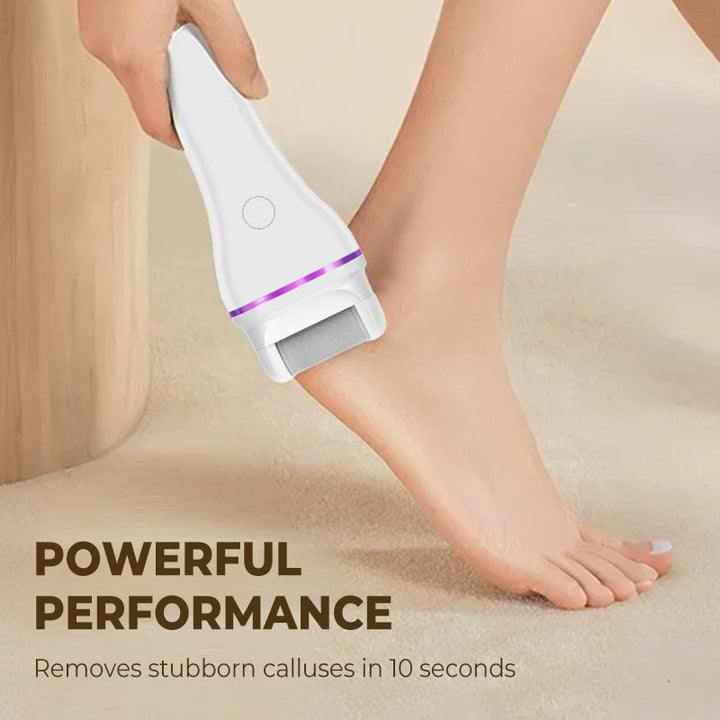 RamelleSmooth™ – Sag Lebewohl zu rauen Füßen und Hallo zu seidig-glatter Haut [50% Rabatt]