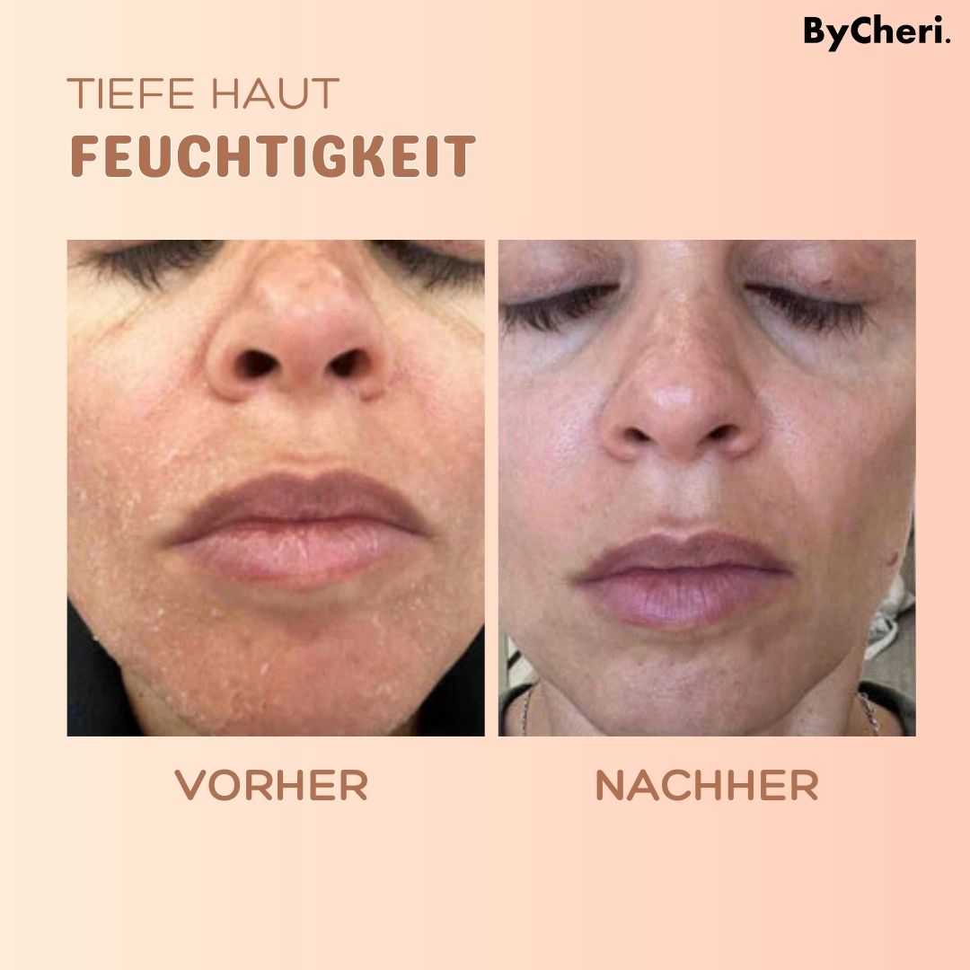 1 + 1 GRATIS HEUTE | MultiBalm™ - Anti-Falten-Hauterneuerungsbalsam