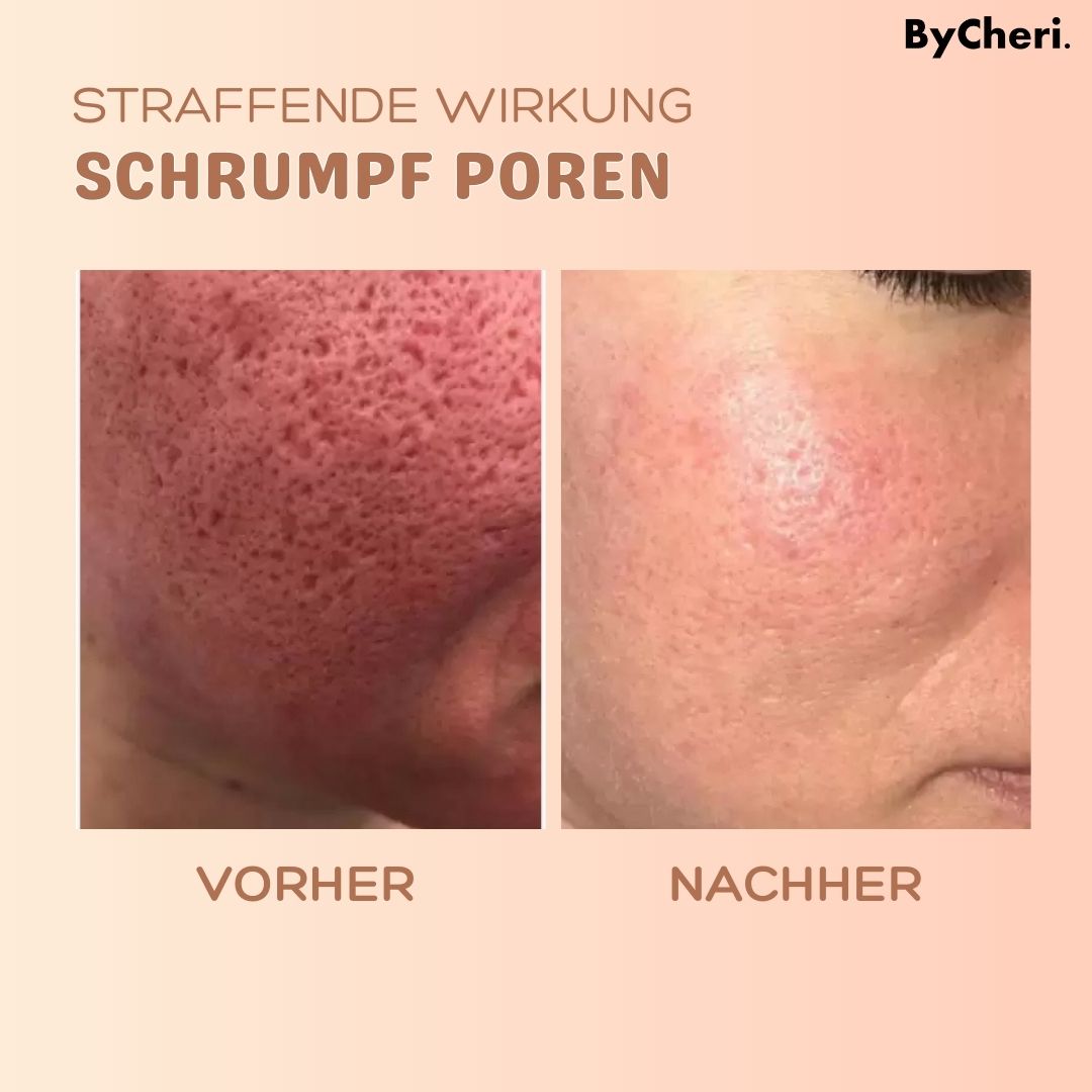 1 + 1 GRATIS HEUTE | MultiBalm™ - Anti-Falten-Hauterneuerungsbalsam