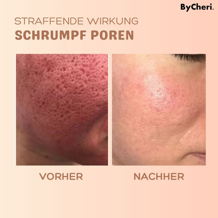 1 + 1 GRATIS HEUTE | MultiBalm™ - Anti-Falten-Hauterneuerungsbalsam