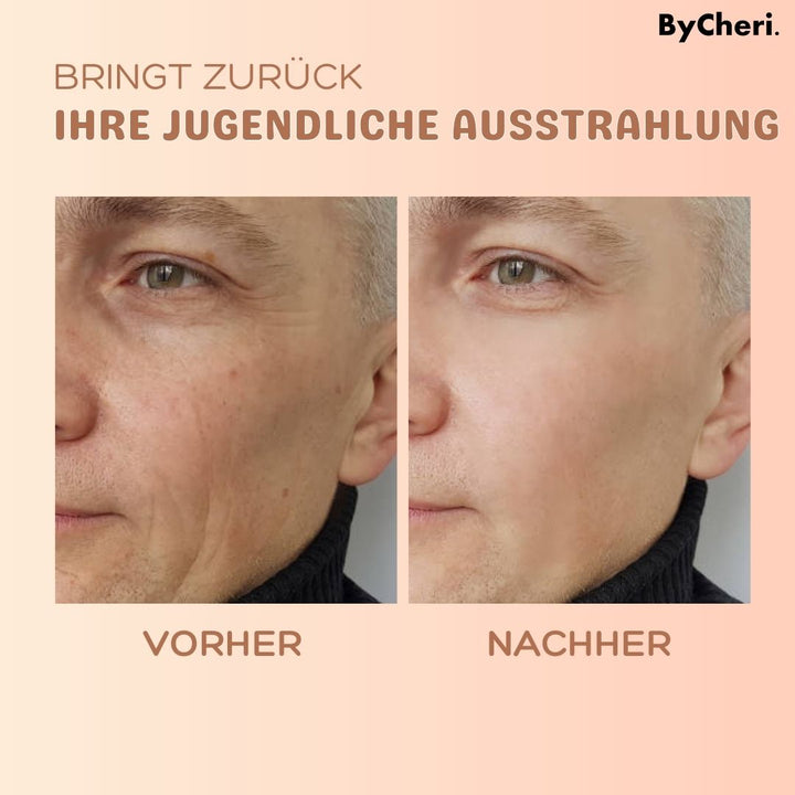 1 + 1 GRATIS HEUTE | MultiBalm™ - Anti-Falten-Hauterneuerungsbalsam