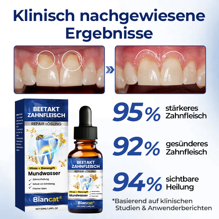 GumViva™ Mundtropfen für frischen Atem und zur Unterstützung des Zahnfleisches