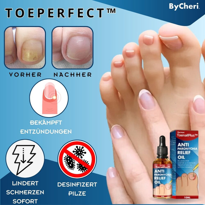 1+1 GRATIS TEMPORÄR | ToePerfect™ - Heilt Zehen- und Handnägel