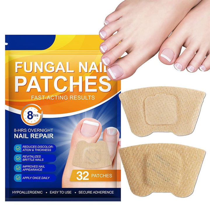 Nailox™ – Für klare, gesunde Nägel mit diskreter Pflege den ganzen Tag lang [1 + 1 Gratis]