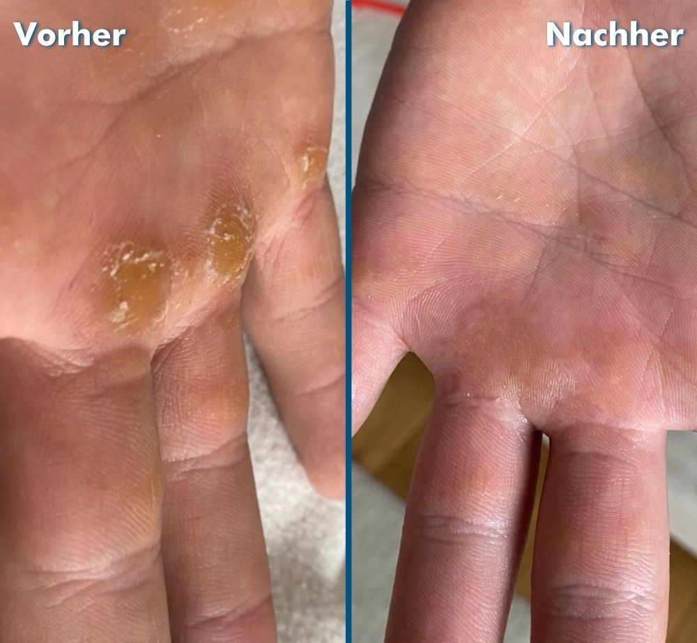 Novaro™ | Hand & Fußpflegebox | Hornhaut Entferner für glatte Füße in 20 Minuten