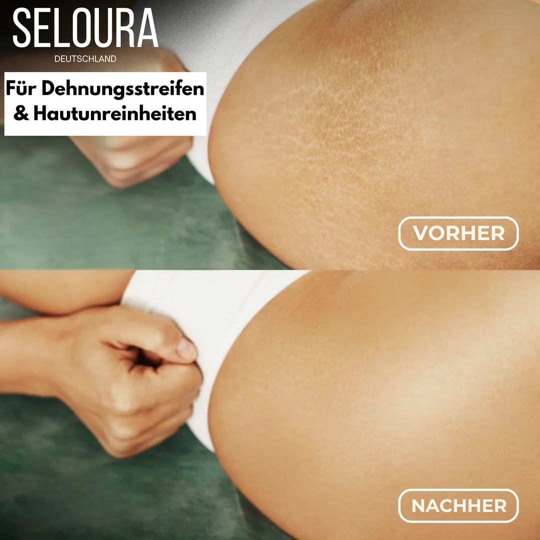 KörperGlanz™ Straffendes Körperöl