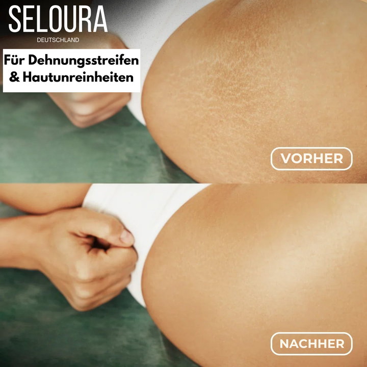 KörperGlanz™ Straffendes Körperöl