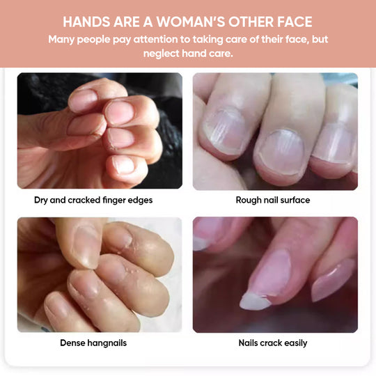 NailGrowth™ – Feuchtigkeitsspendende & stärkende Formel mit Vitamin E & Biotin, 5 g [50% Rabatt]