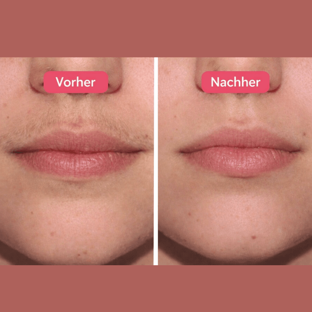 VelvetSkin™ Cyperus-Haarentfernungsöl für sanfte Pflege