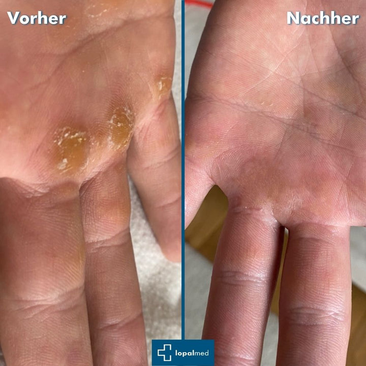 Lopalmed Hand- und Fußpflege-Box pflegt trockene Haut