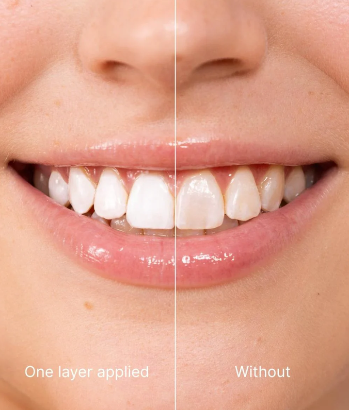 LuminaWhite™ – Sofortiger Fleckneutralisator für gelbe, hartnäckige Verfärbungen [50% Rabatt]