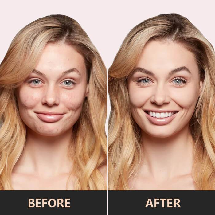 FlawlessSkin™ – Palette Correctrice 3-in-1 für makellose, strahlende und ebenmäßige Haut [50% Rabatt]
