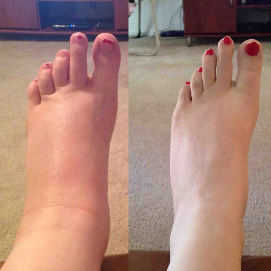 Lymphdrainage-Wellness-Tropfen