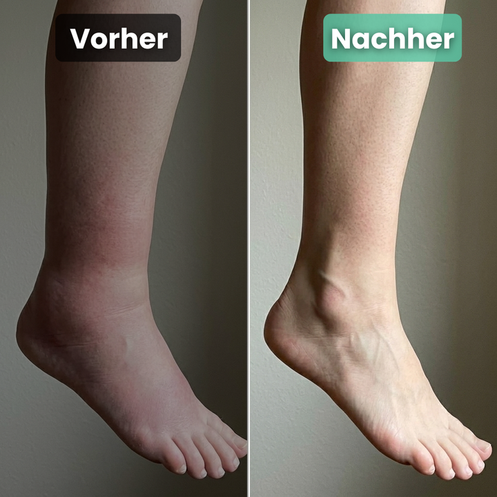 FußWärme™ Elektrische Wärmebandage für den Knöchel