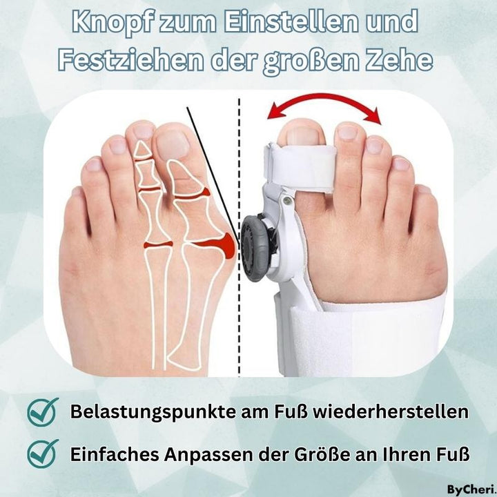 1+1 GRATIS TEMPORÄR | OrthoAlign™ – Großzehenkorrektor