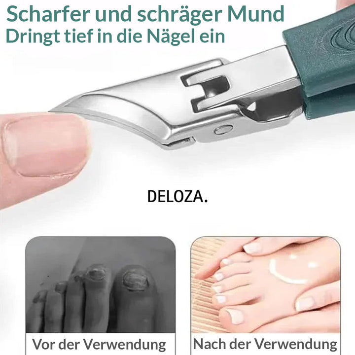 NailEase™-3-teiliges Nagelpflege-Set für eingewachsene Nägel [50% Rabatt]