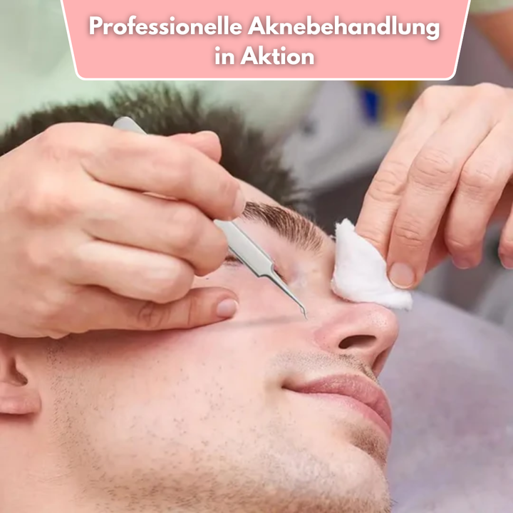 ClearPore™ – Mitesser-Pinzetten-Entferner-Set, präzise, effektiv, sicher & hygienisch [1 + 1 Gratis]