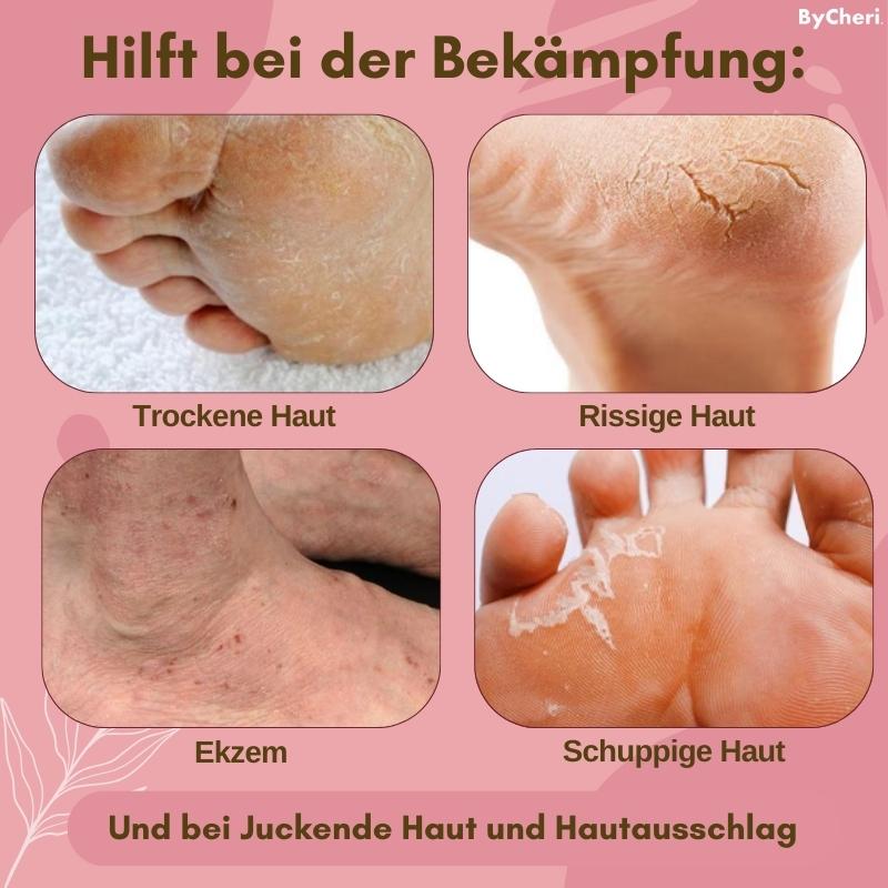 1+1 GRATIS TEMPORÄR | FootVitalize™ - Foot Finish Fußreparaturcreme