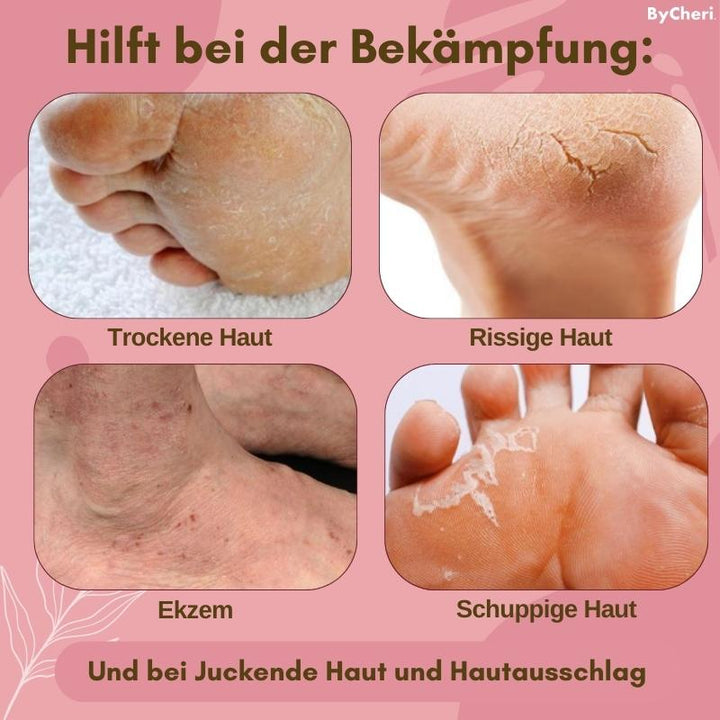 1+1 GRATIS TEMPORÄR | FootVitalize™ - Foot Finish Fußreparaturcreme