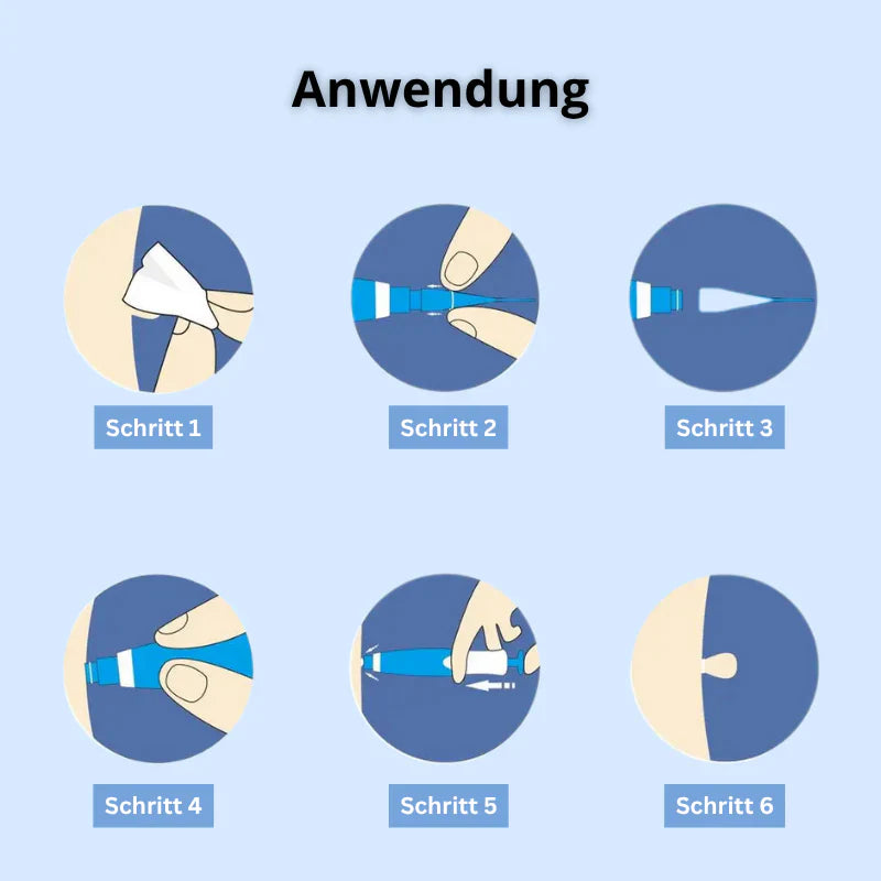 Dermalux® | Nie wieder Hautanhängsel