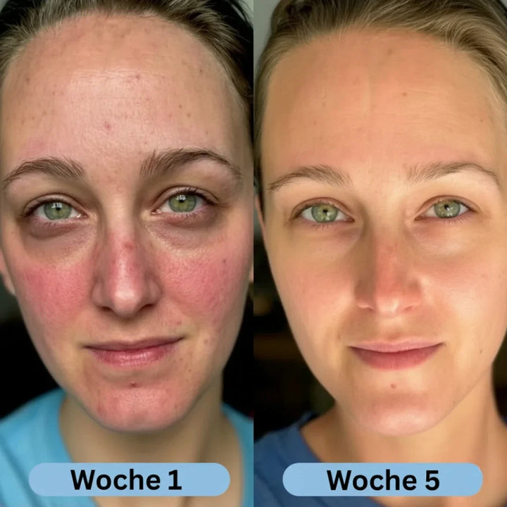 HautVolumen™ Koreanisches Kollagen-Serum für reife Haut