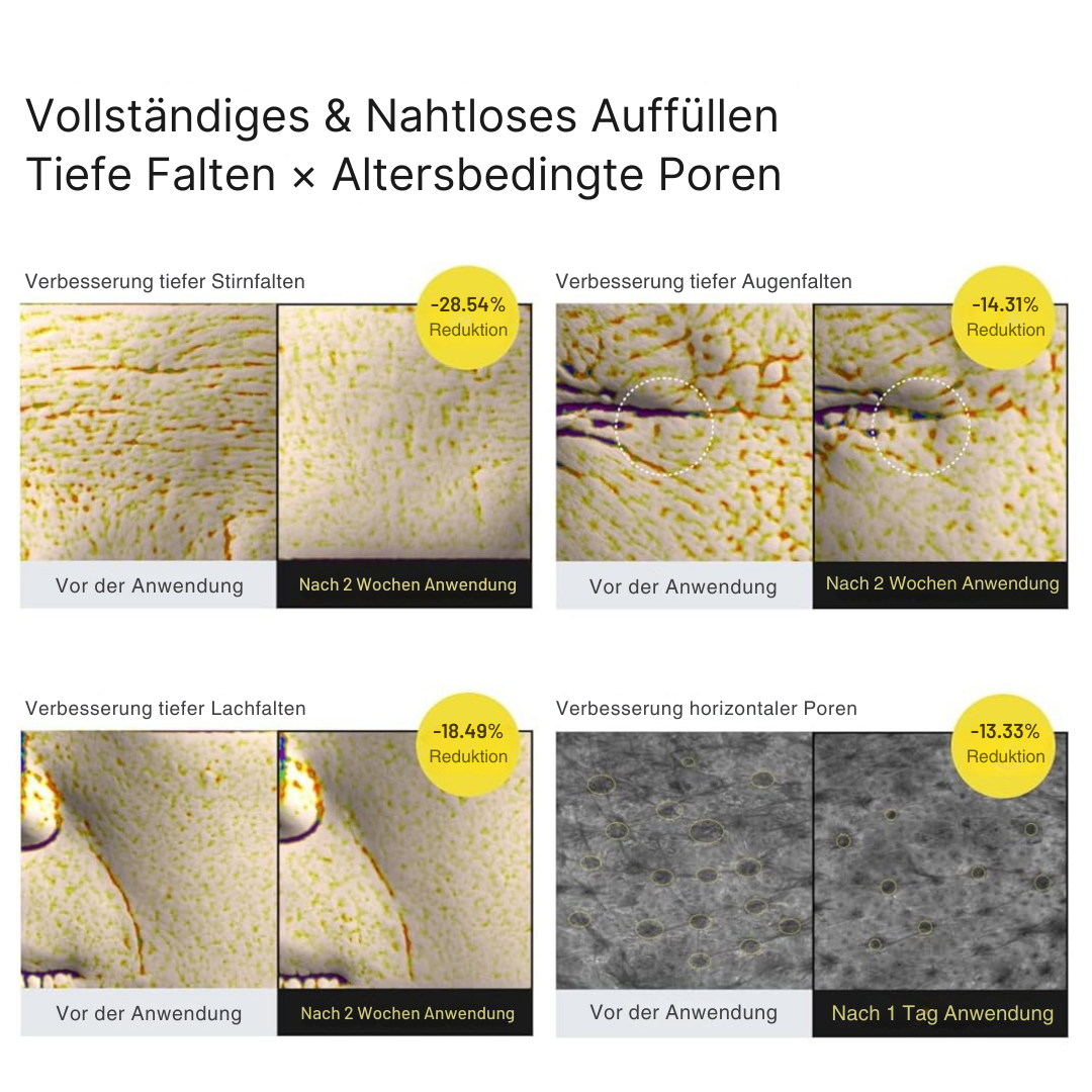Vita-A Straffungspflege - Retinol-Power für sichtbar glattere und straffere Haut