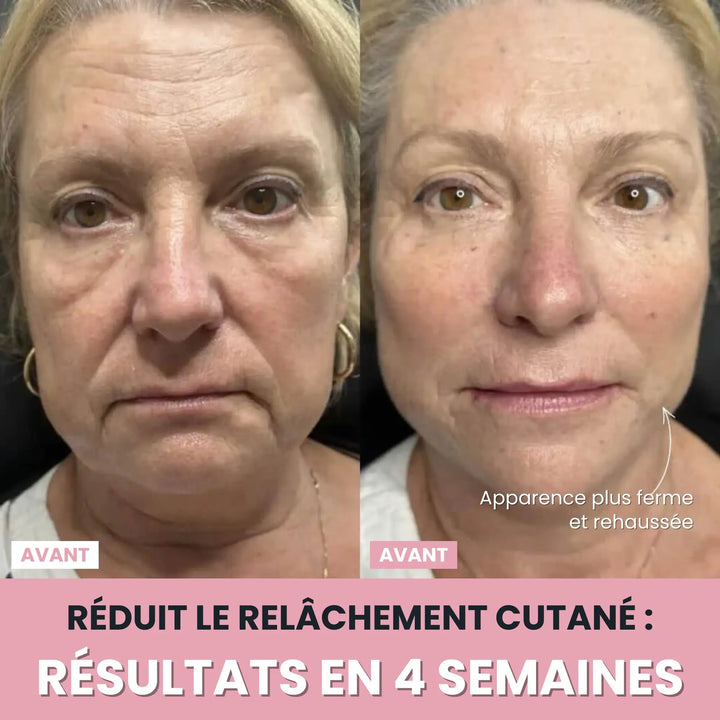 LenaSilk™: 7-in-1 LED-Gesichtsmodellierungsgerät