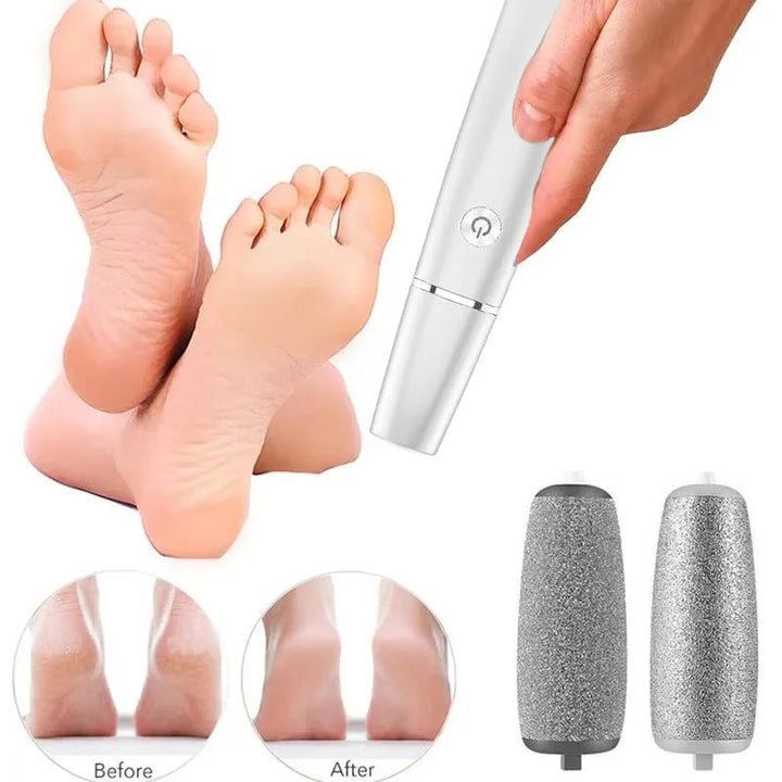 CallusRemove™ – Elektrischer Hornhautentferner für Weiche & Glatte Füße [50% Rabatt]