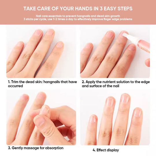 NailGrowth™ – Feuchtigkeitsspendende & stärkende Formel mit Vitamin E & Biotin, 5 g [50% Rabatt]