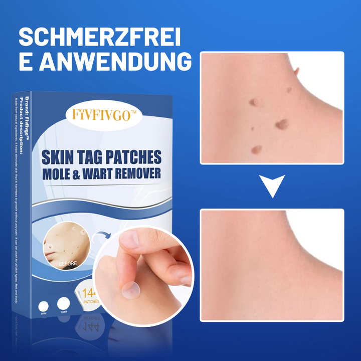 PatchAway™ – Hautlappen schmerzfrei, sicher & mühelos entfernen & pflegen [1 + 1 Gratis]