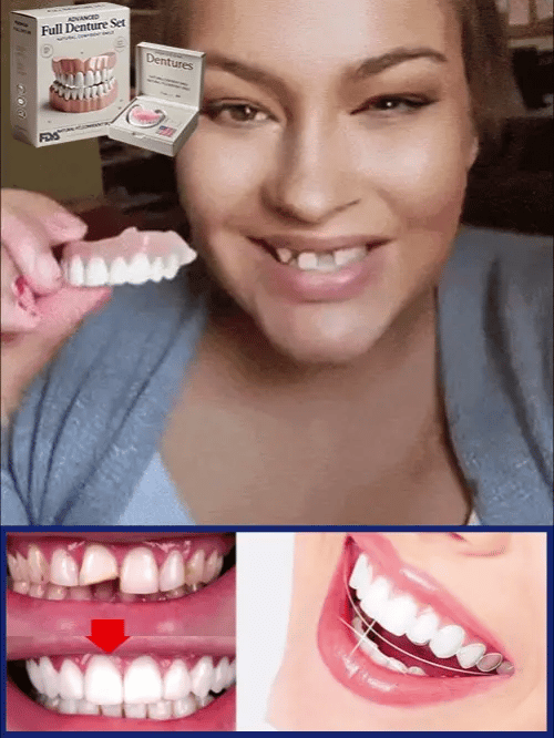 Zahnprothese™ – Natürliches Lächeln, bequeme Passform & wiederverwendbar [50 % Rabatt]